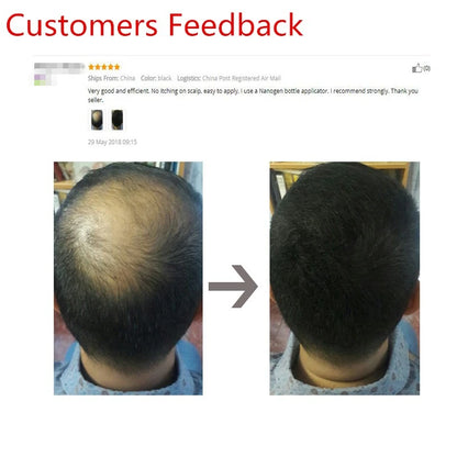 25g Hair Fibers Keratin Thickening Spray Hair Fiber Refill Hair Building Fibers Instant Regrowth Powders Hair Growth Product