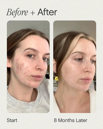 Fade, whiten and clear essence | face cream that can effectively reduce spots and spots