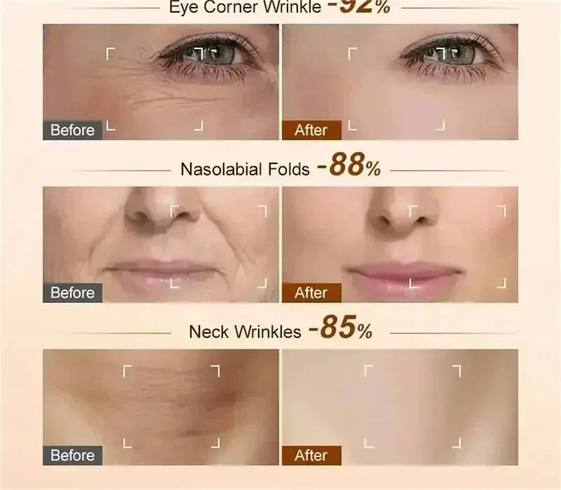 Retinol Anti-Wrinkle Cream Repair Instant Wrinkle Brightening Repair Dispelling Wrinkles Firming Lifting Lightweight Skincare