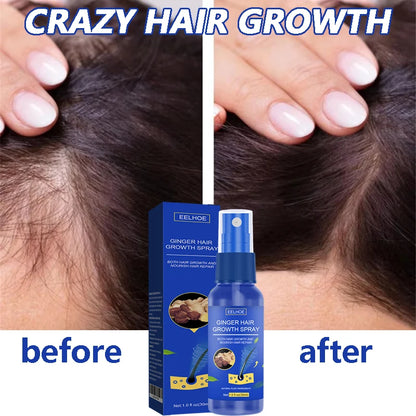 Ginger Hair Growth Serum Spray Anti Loss Regrowth Hair Growth Oil Essence Scalp Massage Moisturizing Nourish Hair Care Men Women