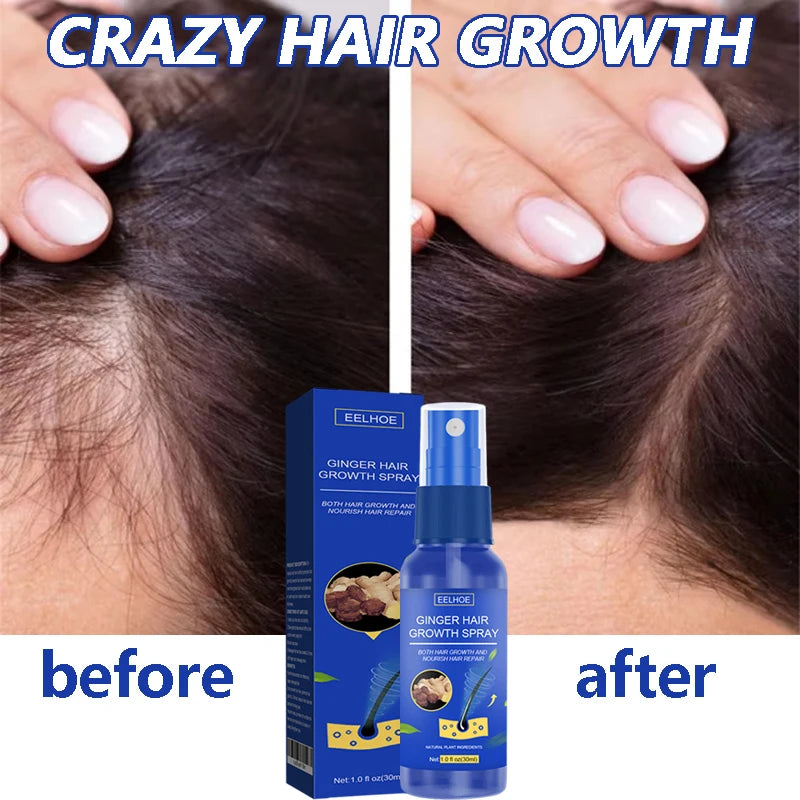 Ginger Hair Growth Serum Spray Anti Loss Regrowth Hair Growth Oil Essence Scalp Massage Moisturizing Nourish Hair Care Men Women