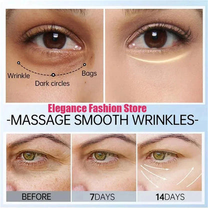 Instant Eye Bag Remove Eye Cream Anti Fat Particles Dark Circles Puffiness Fade Fine Lines Lift Brighten Korean Beauty Eye Care