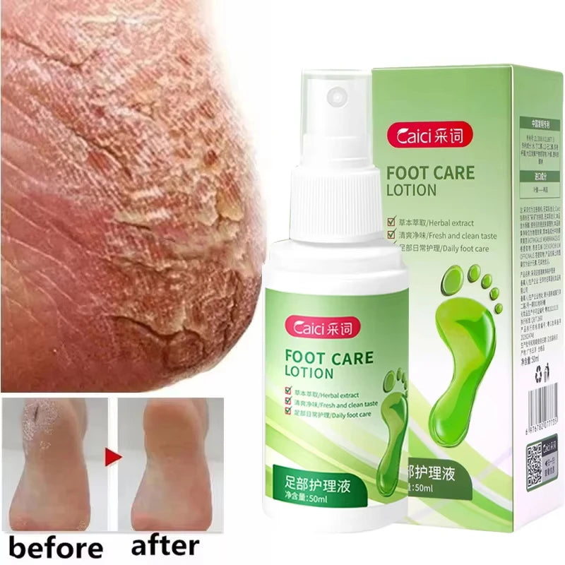 Herbal Anti Crack Foot Cream Spray Heel Cracking Repair Products Exfoliation Dead Skin Removal Softening Moisturize Smooth Care