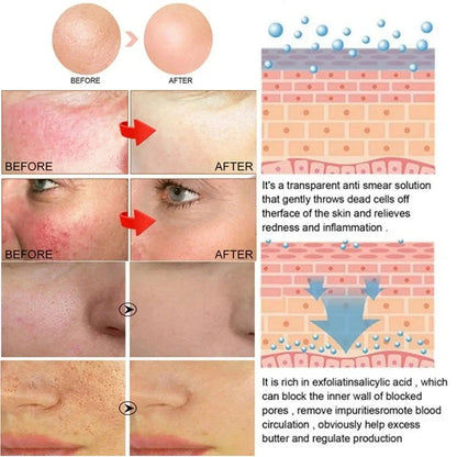 Facial Redness Repair Capsule Oil Improve Sensitive Skin Dryness Moisturizer Soothing Serum Removal Rosacea Korean Cosmetics