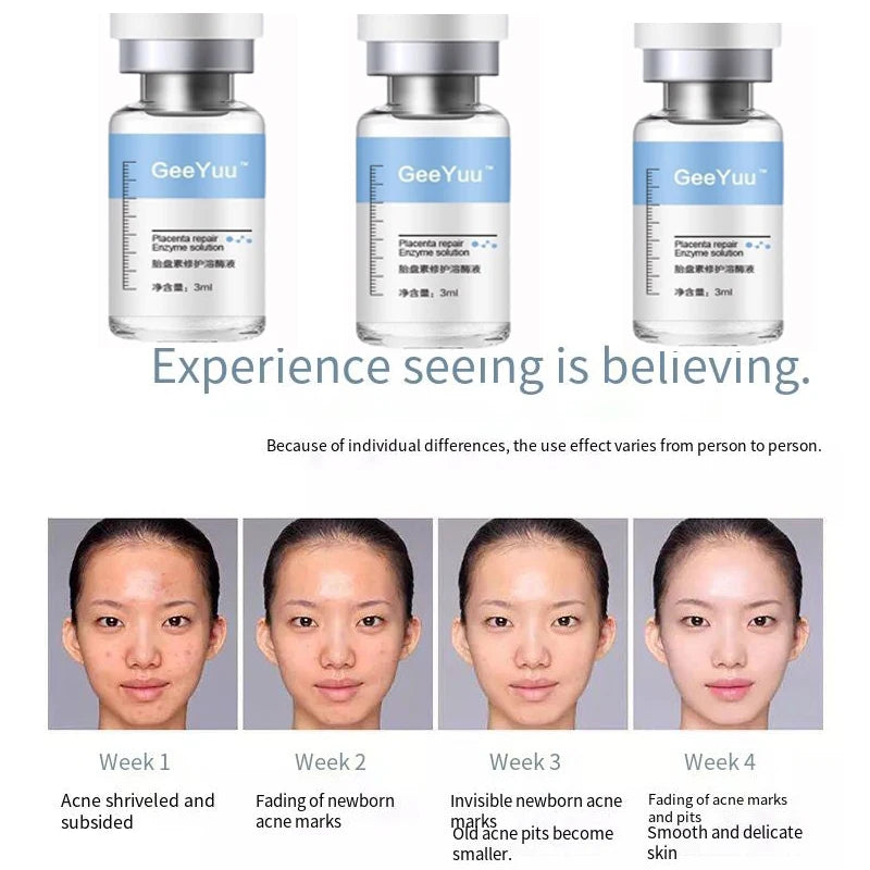 Placent Peptide Ampoule Hyaluronic acid Serum For Face Dr.Pen  Freeze-dried Powder Repair Moisturizing Skin Care Korean