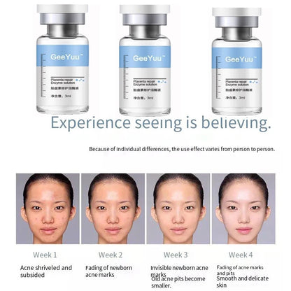 Placent Peptide Ampoule Hyaluronic acid Serum For Face Dr.Pen  Freeze-dried Powder Repair Moisturizing Skin Care Korean