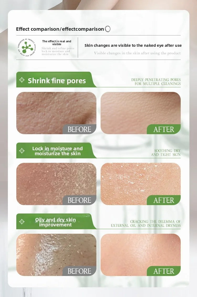 Rosemary Hydrosol essence Moisturizing Serum Fade Fine Lines Facial Moisturizing brightning Anti Aging Firming Skin Care
