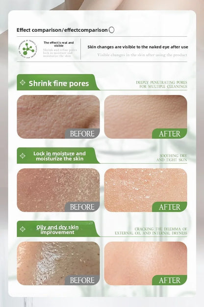 Rosemary Hydrosol essence Moisturizing Serum Fade Fine Lines Facial Moisturizing brightning Anti Aging Firming Skin Care