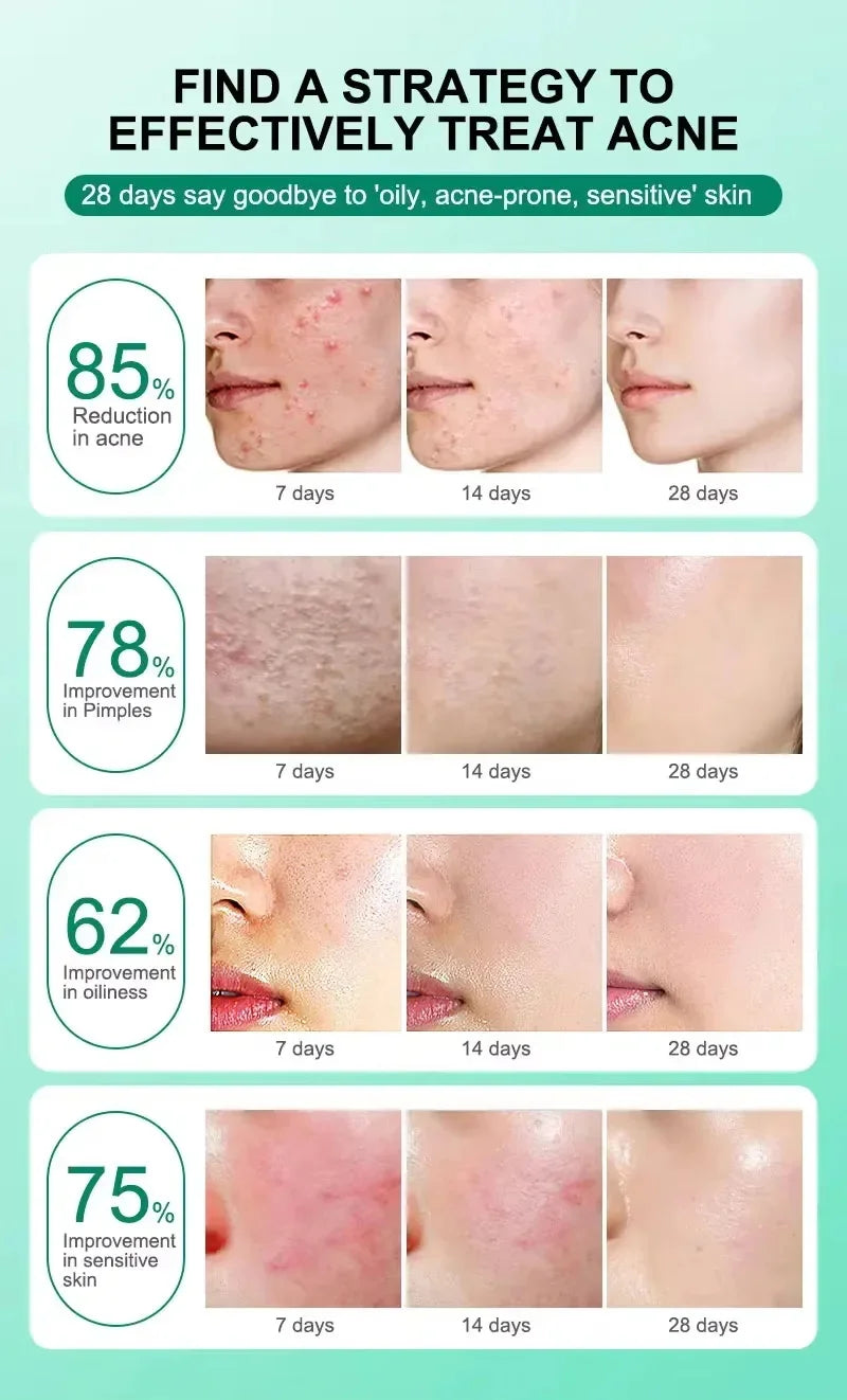 Repair Facial Redness Cream Instant Spider Vein Remove Sensitive Skin Sooth Anti Redness Rosacea Treat Lotion Korean Cosmetics