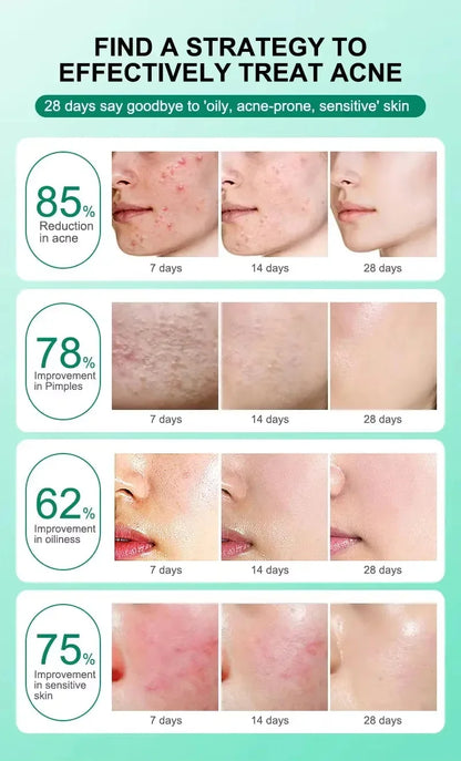 Repair Facial Redness Cream Instant Spider Vein Remove Sensitive Skin Sooth Anti Redness Rosacea Treat Lotion Korean Cosmetics
