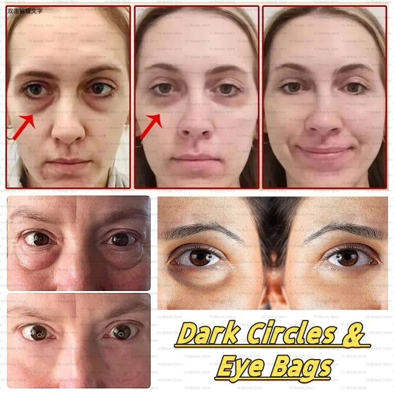 Instant Eye Bag Removal Cream Collagen Anti-Wrinkle Fade Fine Lines Firming Skin Anti Dark Circle Puffiness Brighten Eye Care