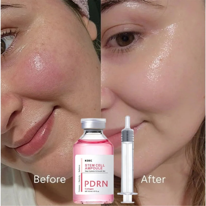 PDRN & Collagen Stem Cell Ampoule Deep Hydration Smooth Skin Enhance Skin Elasticity Nourishing Firming Facial Serum