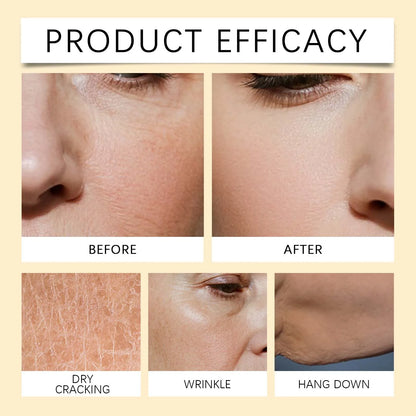 Bee Venom Face Body Serum Anti-Wrinkle Firming Essence Reduces Fine Lines Brightens Nourishing Smoothing Firming Massage Care