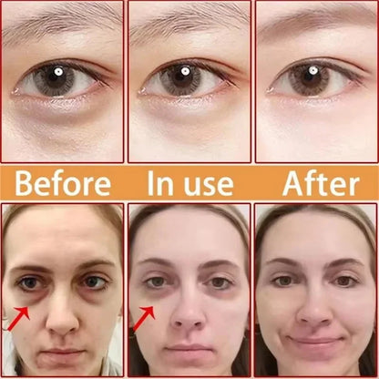 Instant Eye Bag Removal Cream Collagen Anti-Wrinkle Firming Skin Fade Fine Lines Anti Dark Circle Puffiness Brighten Eye Care