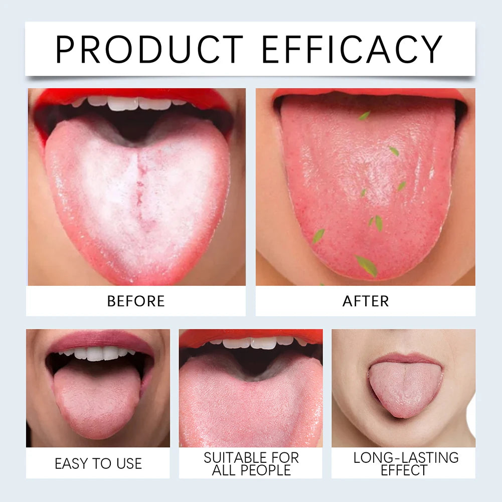 50ml Tongue Cleaning Gel Set,For Bad Breath Long Lasting-Freshness Mouth Odor-Eliminators,Tongue Cleaning Paste For Home
