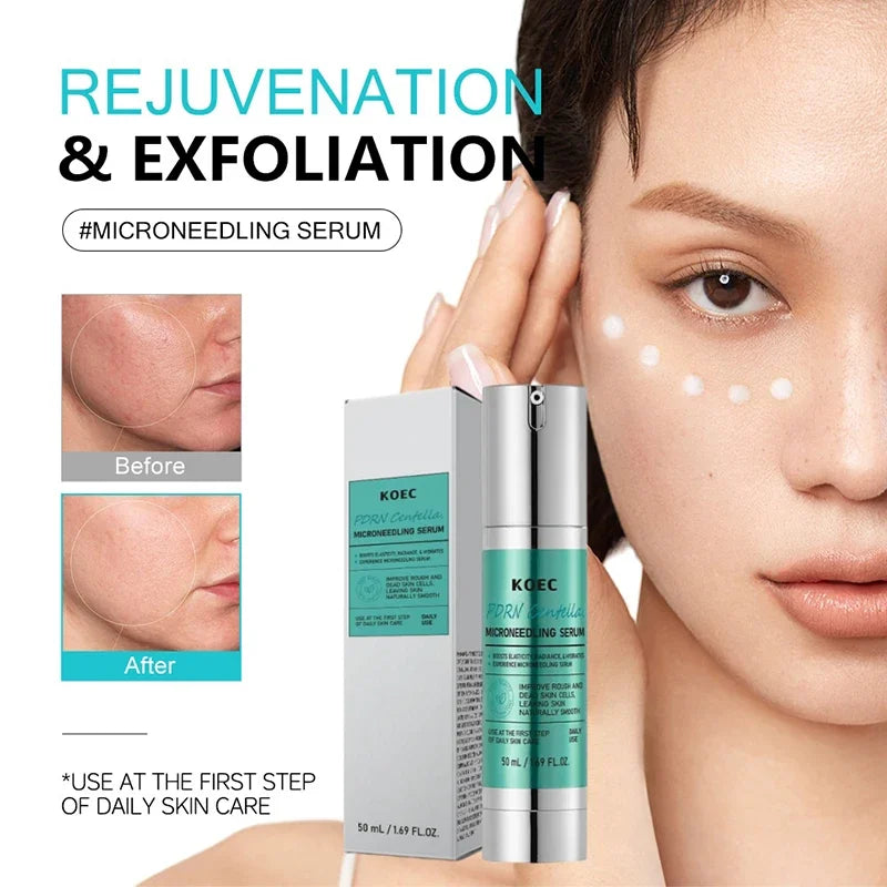 Korean Centella Asiatica Extract Soothes Moisturize Soft Firm Brighten Repair Skin Facial Collagen Microneedle Essence Lotion
