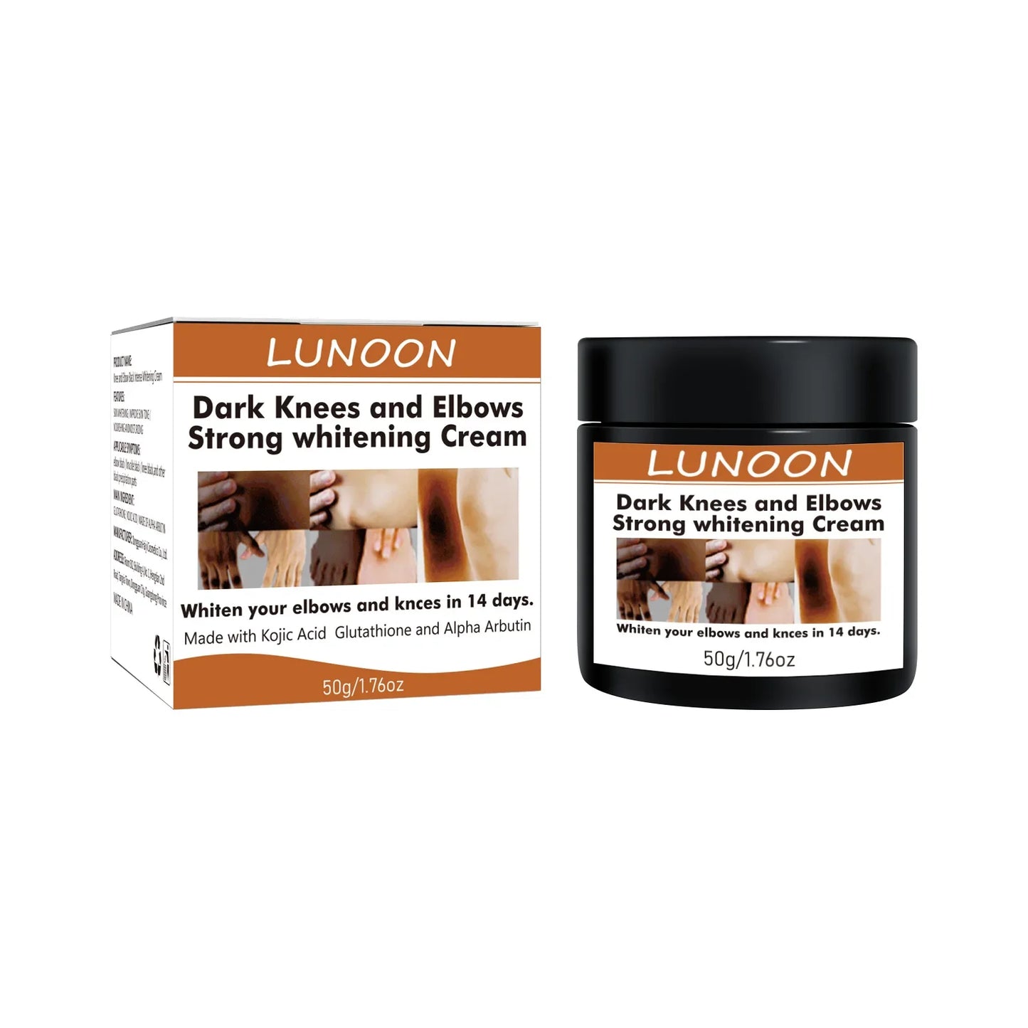 Dark Knuckle Wh-itening Cream Brighten Moisturizing Remover Pigmentation Brightening Knees Skin Care Bleaching Cream