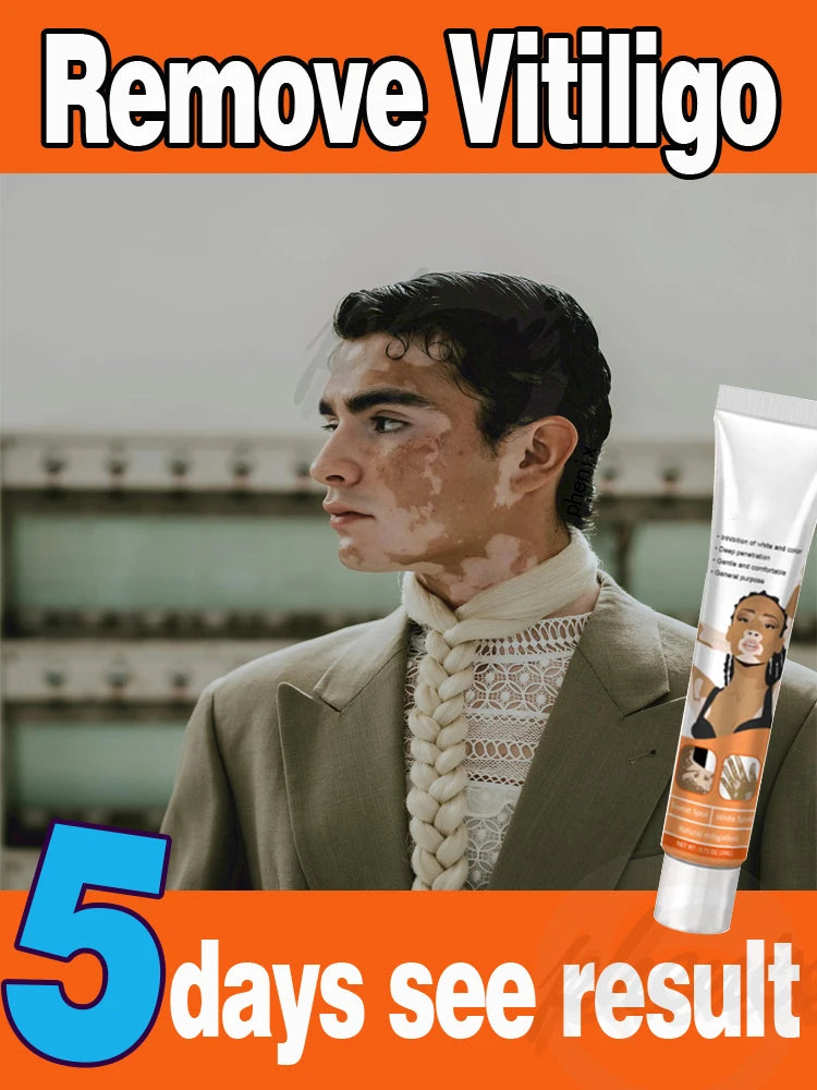 Vitiligo cream, men's and women's skin care essence