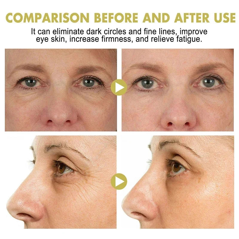 Snail Eye Cream Stick Collagen Fade Fine Lines Wrinkle Lightening Dark Circles Firming Eye Bags Puffiness Moisturizing Eye Cream