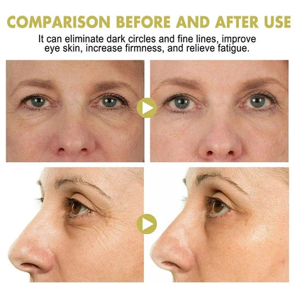 Snail Eye Cream Stick Collagen Fade Fine Lines Wrinkle Lightening Dark Circles Firming Eye Bags Puffiness Moisturizing Eye Cream