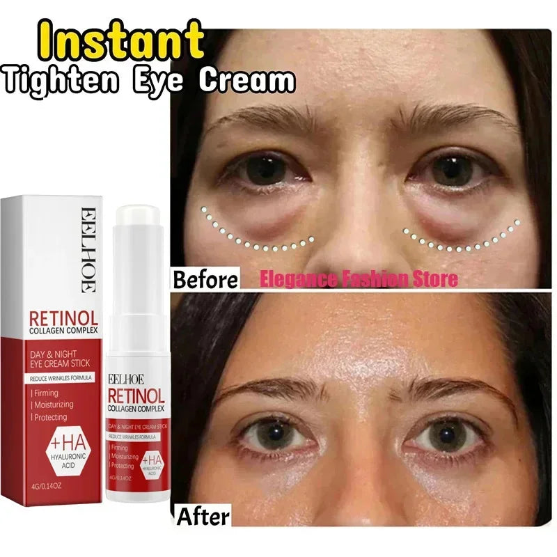 Instant Eye Bag Remove Eye Cream Anti Fat Particles Dark Circles Puffiness Fade Fine Lines Lift Brighten Korean Beauty Eye Care