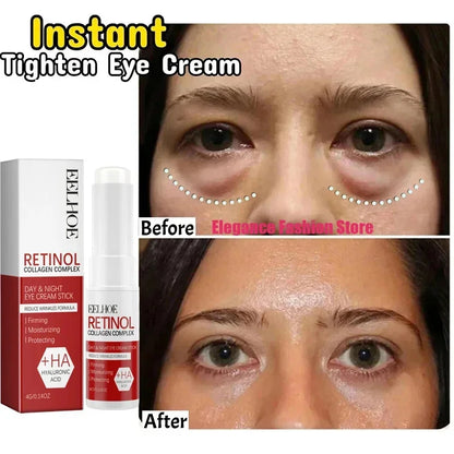 Instant Eye Bag Remove Eye Cream Anti Fat Particles Dark Circles Puffiness Fade Fine Lines Lift Brighten Korean Beauty Eye Care