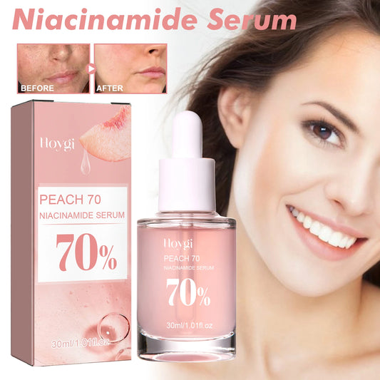 Niacinamide Serum 30ml Brightening Pore Minimizer Fade Dark Spots Hydrating Even Skin Tone Anti Aging Face Serum Non Irritating