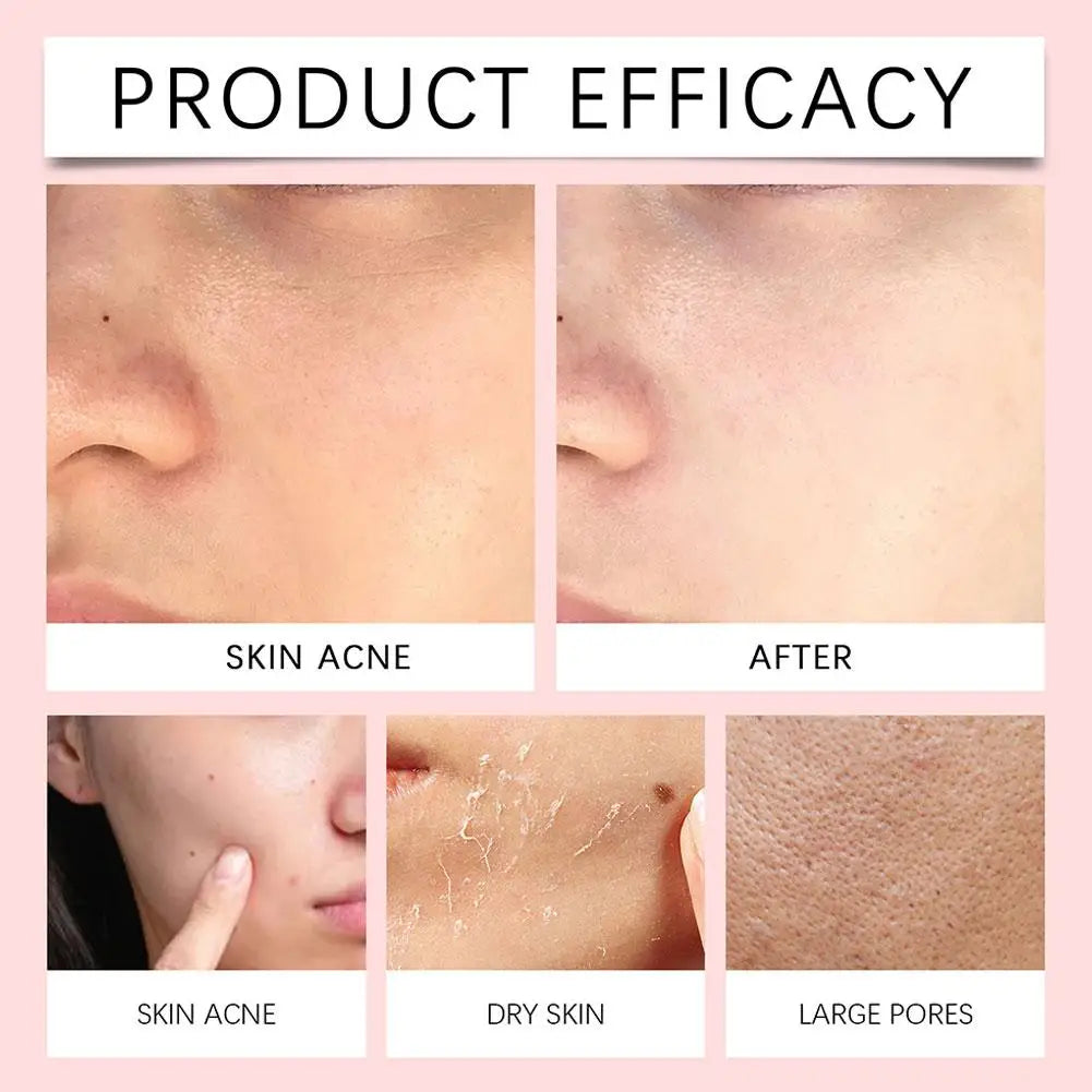 Soothing Centella Asiatica Mild Deep Cleansing Foam Cleanser - Remove Pore Oil Control Exfoliating Refresh Facial Skincare