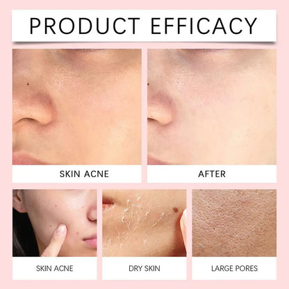 Soothing Centella Asiatica Mild Deep Cleansing Foam Cleanser - Remove Pore Oil Control Exfoliating Refresh Facial Skincare