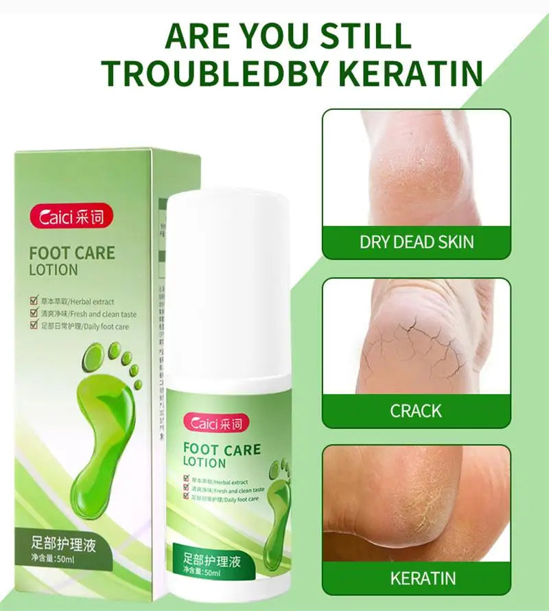 Herbal Anti Crack Foot Cream Spray Heel Cracking Repair Products Exfoliation Dead Skin Removal Softening Moisturize Smooth Care