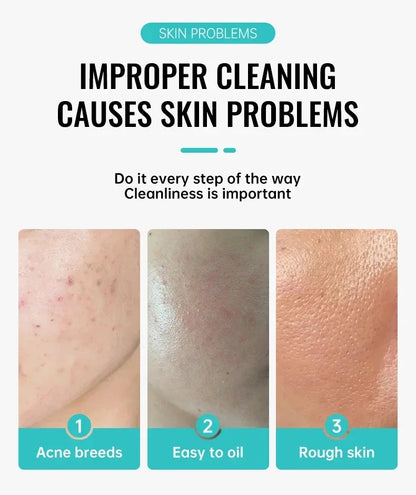 Herbal Acne Removal Face Cream Clears Pimple Scar Black Dots Gel Acne Treatment Shrink Pore Skin Whitening Lightening Ointment