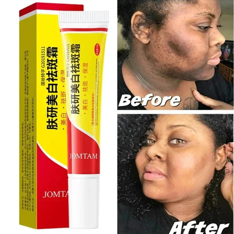 Whitening Freckle Cream Face Brightening Cream Niacinamide Reduce Chloasma Melasma Melanin Fade Fine Lines Lighten Dark Skincare