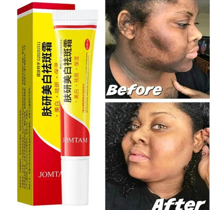 Whitening Freckle Cream Face Brightening Cream Niacinamide Reduce Chloasma Melasma Melanin Fade Fine Lines Lighten Dark Skincare