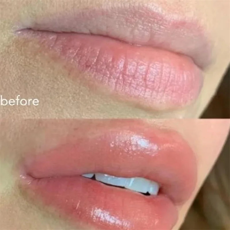 Glow Tulip Lip Plumper Spicule Plumping Lip Shot Extreme Lip Plumper Gloss Extreme Volume Serum Oil Sexy Beauty Makeup Korean
