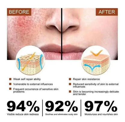 Repair Facial Redness Cream Instant Spider Vein Remove Sensitive Skin Sooth Anti Redness Rosacea Treat Lotion Korean Cosmetics