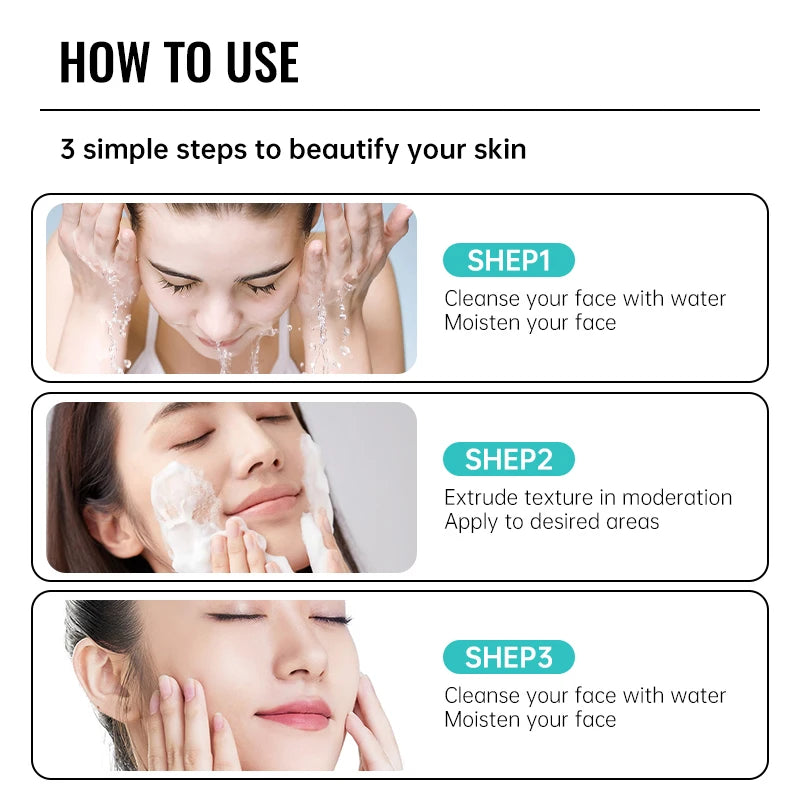 Herbal Acne Removal Face Cream Clears Pimple Scar Black Dots Gel Acne Treatment Shrink Pore Skin Whitening Lightening Ointment