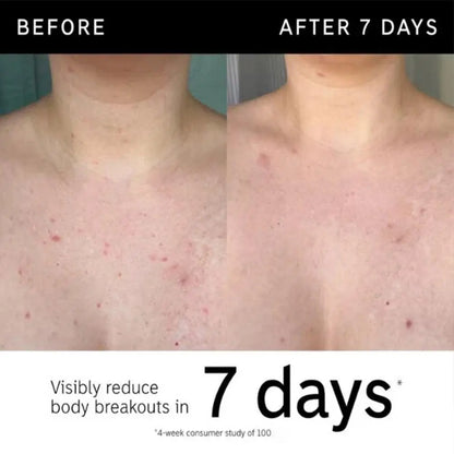 Korean Gentle Deep Cleansing Exfoliating Gel - Remove Blackhead Shrink Pores Whiten Moisturizing Daily Facial Skincare