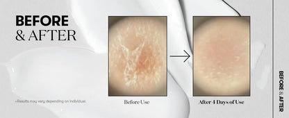 Vt Desalination Of Fine Lines, Collagen Reverse Aging, Recombinant Enhancement , Collagen Solution ,Korean Skincare,50ml