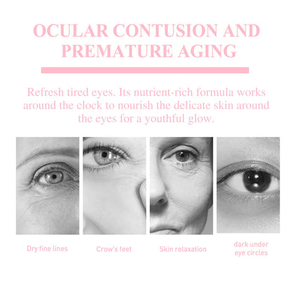 Retinol Eye Cream Stick Lifting Fade Fine Line Remove Dark Circles Eye Bags Anti Puffiness Moisturizing Smoothing Eye Skin Care