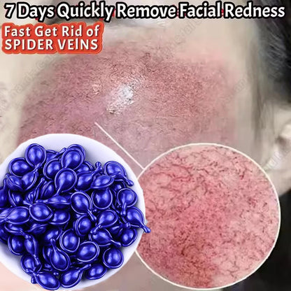 Facial Redness Repair Capsule Oil Improve Sensitive Skin Dryness Moisturizer Soothing Serum Removal Rosacea Korean Cosmetics