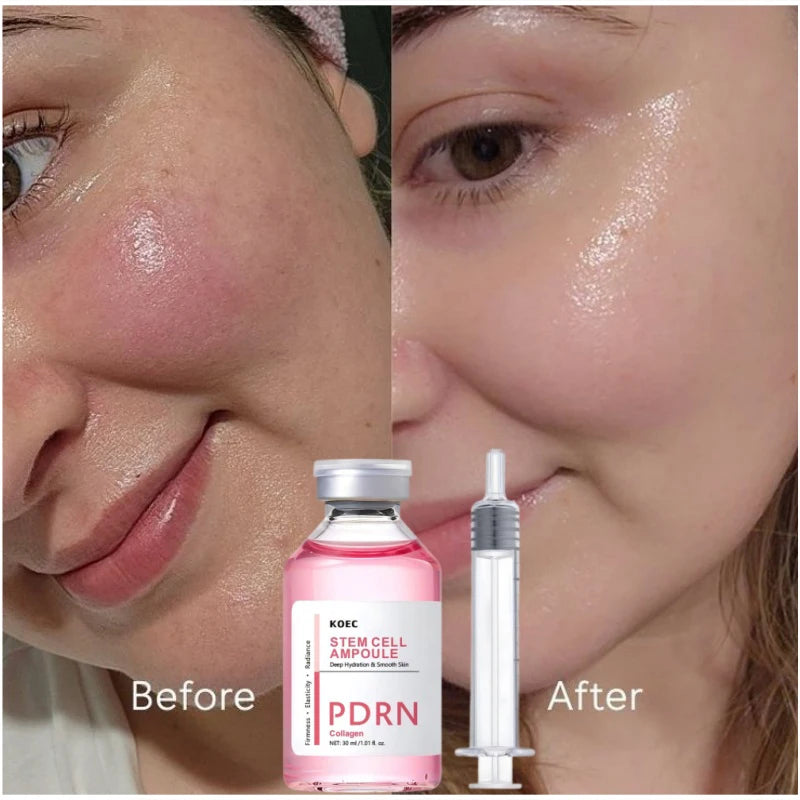 PDRN & Collagen Stem Cell Ampoule Deep Hydration Smooth Skin Enhance Skin Elasticity Nourishing Firming Facial Serum