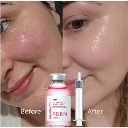PDRN & Collagen Stem Cell Ampoule Deep Hydration Smooth Skin Enhance Skin Elasticity Nourishing Firming Facial Serum