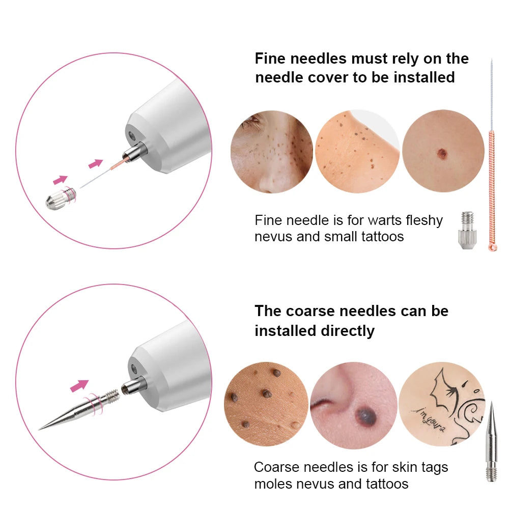 Laser Plasma Pen Needles Set For Dark Spot Freckle Mole Wart Tattoo Skin Tag Remover Face Skin Care Tool Replacement Accessories