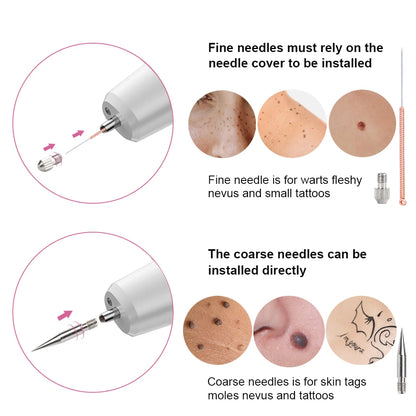 Laser Plasma Pen Needles Set For Dark Spot Freckle Mole Wart Tattoo Skin Tag Remover Face Skin Care Tool Replacement Accessories