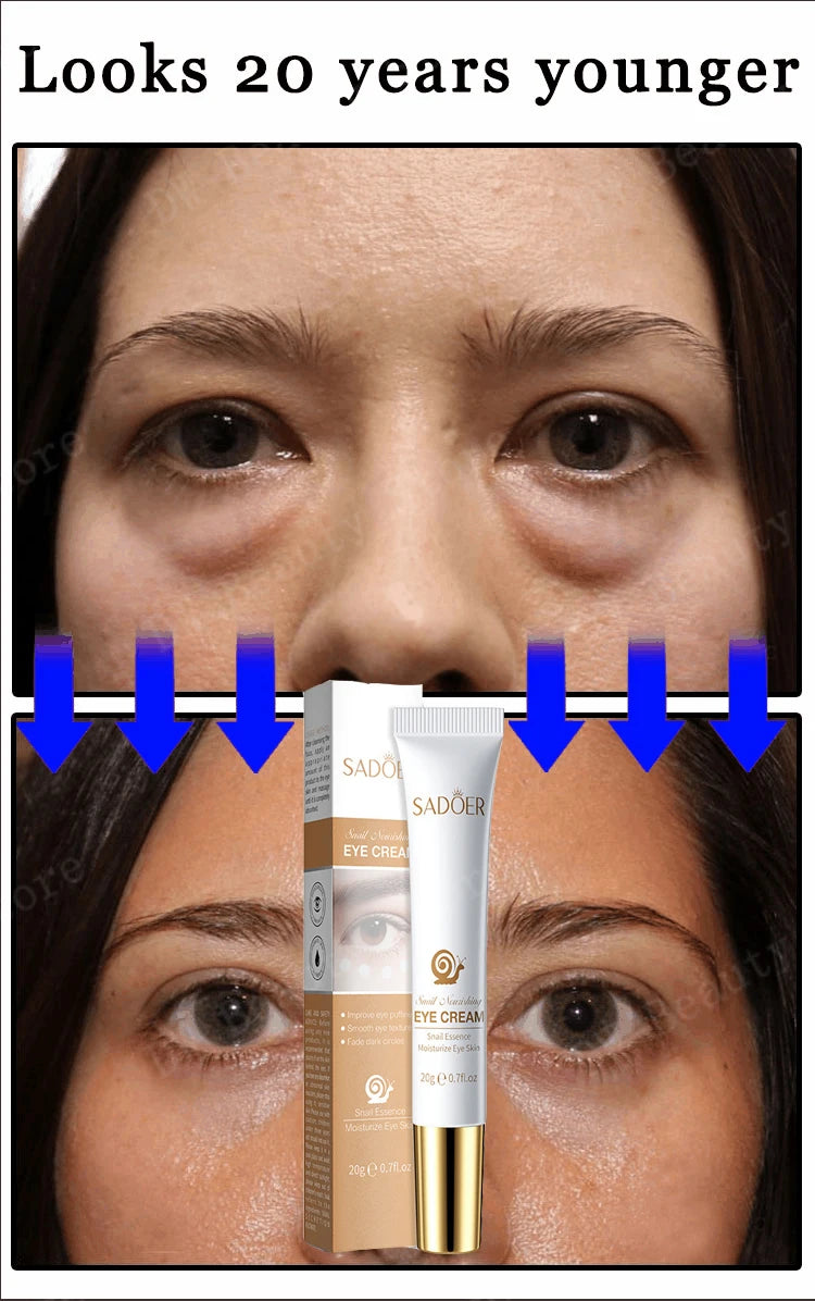 Instant Eye Bag Removal Cream Collagen Removal Wrinkles Lifting Fade Fine Lines Moisturizing Brightening Anti Puffiness Eye Care