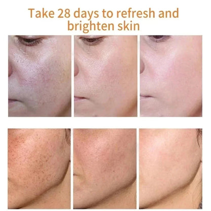 Whitening Freckle Cream Face Brightening Cream Niacinamide Reduce Chloasma Melasma Melanin Fade Fine Lines Lighten Dark Skincare