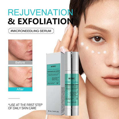 Spicule Microneedling Serum,Pore Exfoliation,Centella Asiatica Propolis Aloe Extract Moisturizing Booster,Korean Glass Skin Care