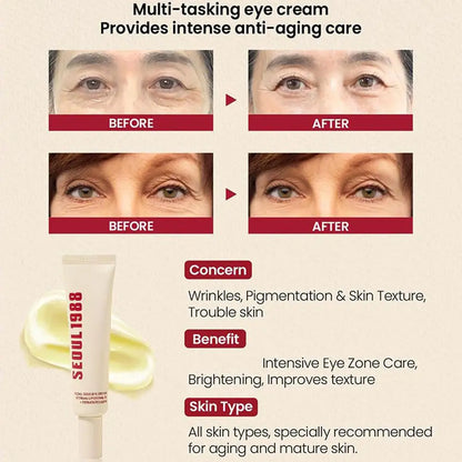 Seoul 1988 Eye Cream Niacinamide Retinoic Acid Ginseng Essence Firm Cream Lighten Fine Lines Deep Moisturizing Care Essence Set