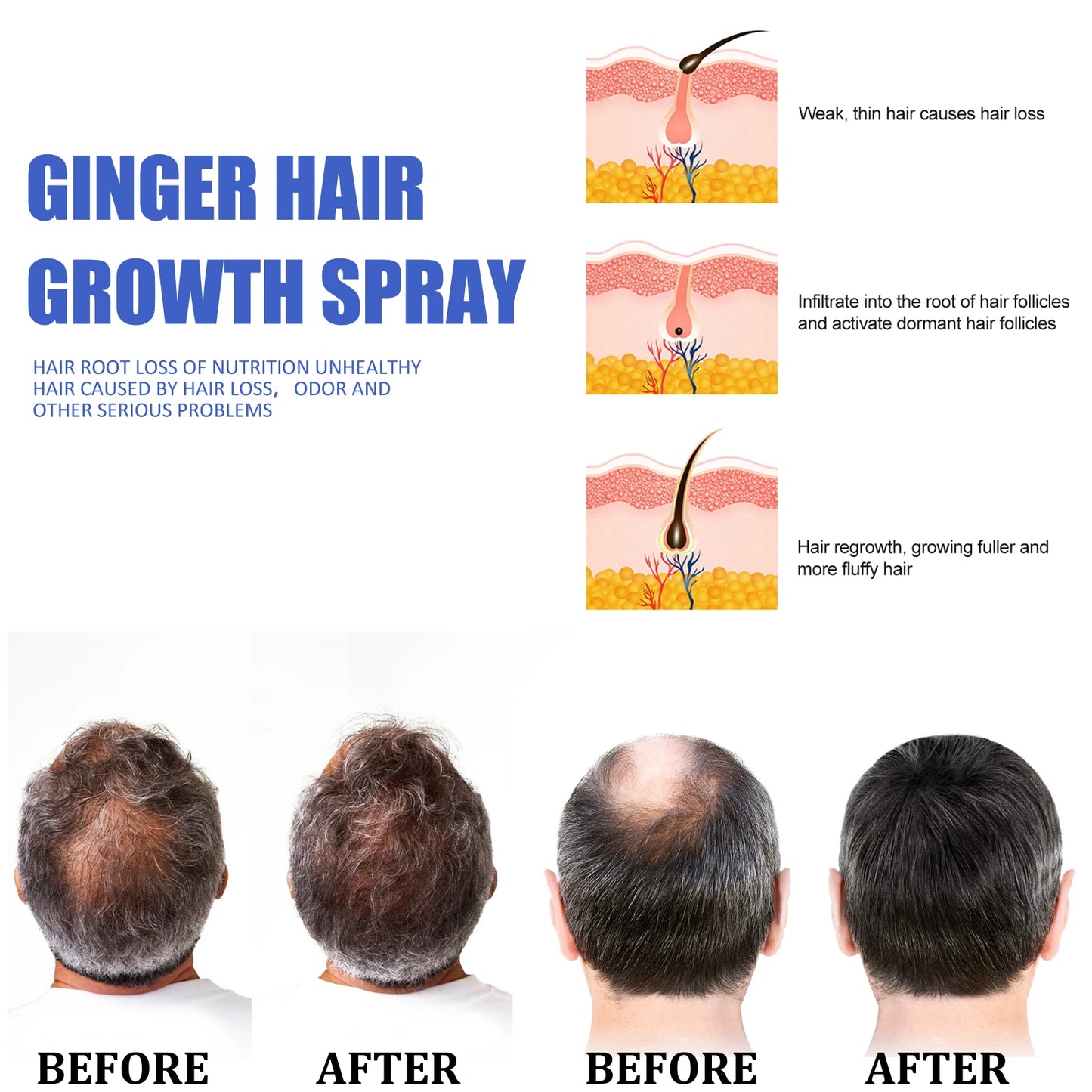 Ginger Hair Growth Serum Spray Anti Loss Regrowth Hair Growth Oil Essence Scalp Massage Moisturizing Nourish Hair Care Men Women