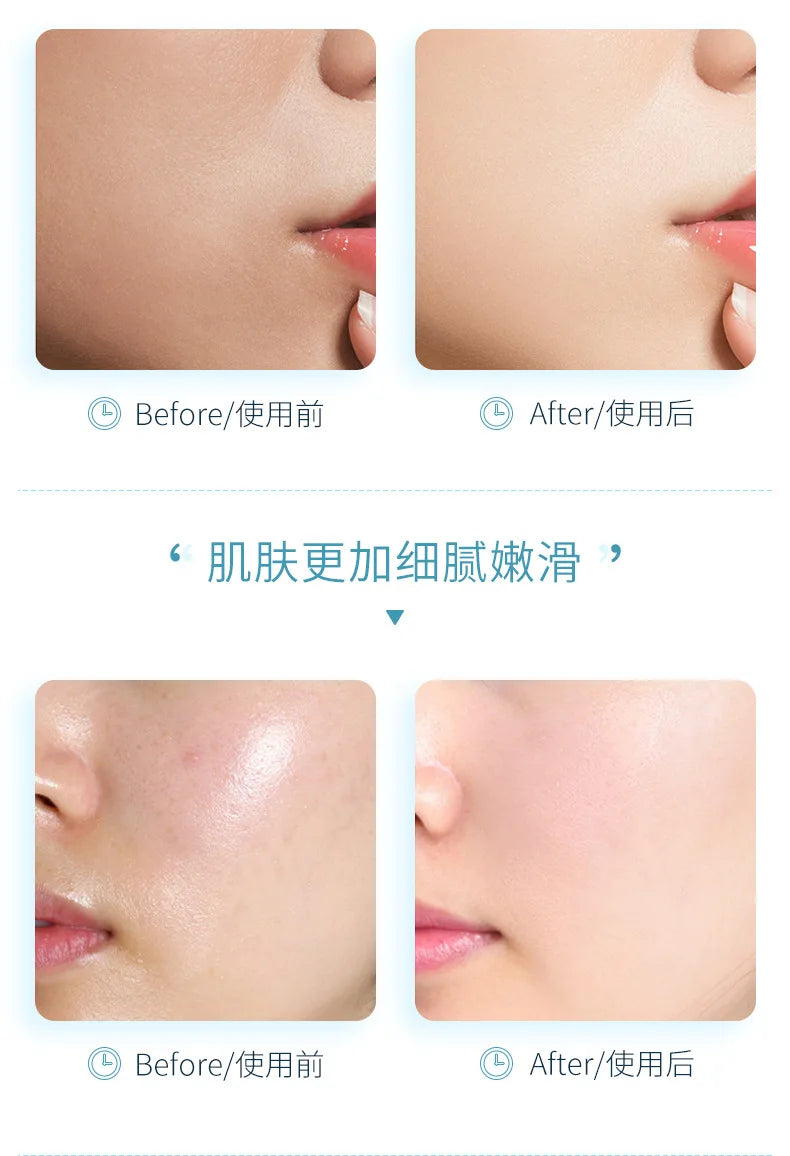300ml Hyaluronic Acid Hydrating Mineral Spring Hydrating Spray Deep Moisturizing Emollient Refreshing Oil Control Gentle Repair